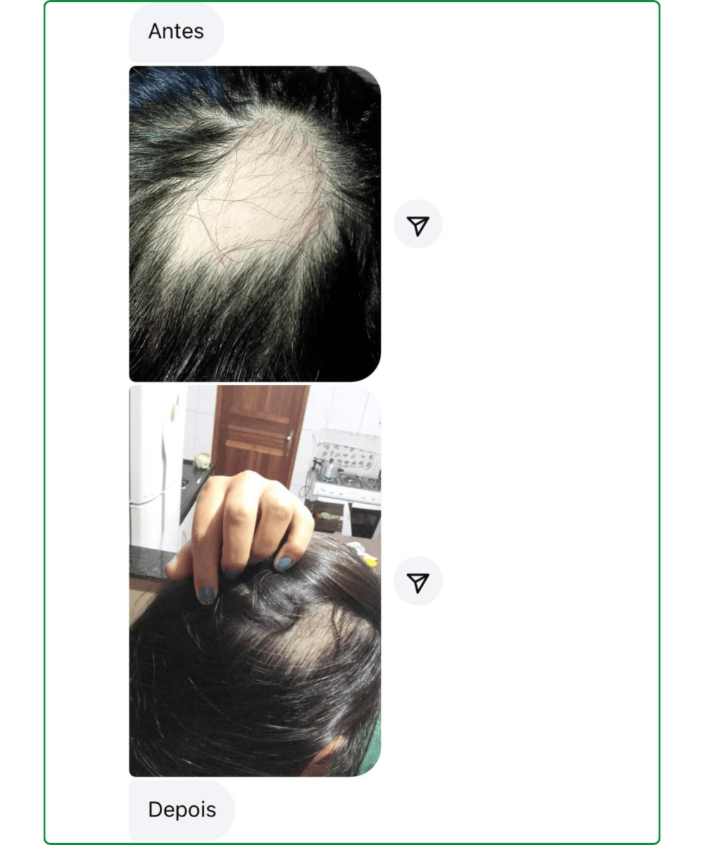 Depoimento 2